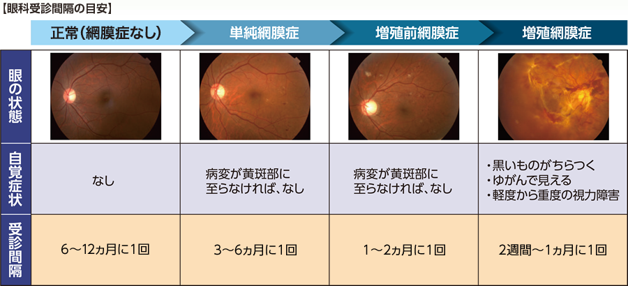 眼科受診の大切さ | 糖尿病黄斑浮腫 | 網膜ドットコム | ノバルティス 